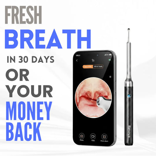 Renova TonsilFresh™